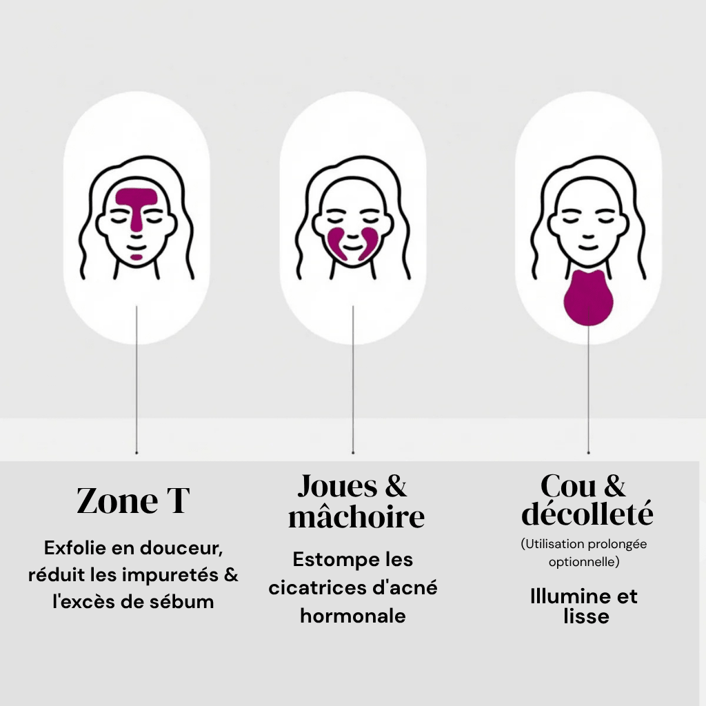 Gloe Arbutine 7% + Acide Tranexamique 4% Crème
